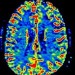 colorful MRI of normal brain